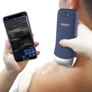 Scanner a ultrasuoni portatile portatile a ultrasuoni a 250 grammo Wireless a ultrasuoni