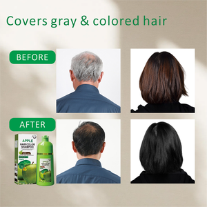 WELLTNO Natural Factory Champú <span class=keywords><strong>Tinte</strong></span> para el Cabello Transparente, No Mancha la Piel, el Más Vendido para Personas Mayores - Product Image 5