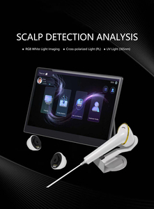 Analyseur capillaire portable pour le cuir chevelu – Scanner et détecteur de follicules pileux pour l'analyse des cheveux et les soins du cuir chevelu - Product Image 2