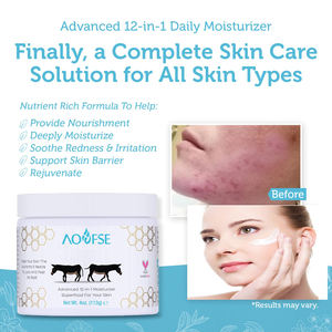 OEM Crème pour le <span class=keywords><strong>visage</strong></span> au <span class=keywords><strong>lait</strong></span> <span class=keywords><strong>d</strong></span>'ânesse anti-allergène naturel - Product Image 5