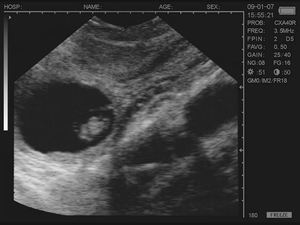 Machine à ultrasons vétérinaire non invasive avancée pour le diagnostic précoce de la grossesse chez les truies et les brebis - Product Image 5