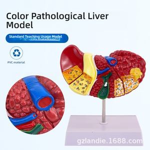 Modèle de foie en plastique PVC coloré Caractéristiques pathologiques cliniques communes Aide à la communication pour les médecins en hépatologie Gastroentérologie - Product Image 4