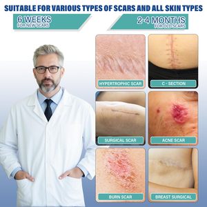 Láminas de Silicona para Cicatrices, Grado Médico, para Cirugía, Cesárea, Queloides, Quemaduras, Tiras Reutilizables para Eliminar Cicatrices, Cortables a Medida - Product Image 2