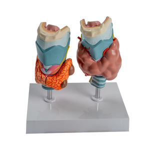 Modelo Patológico de Tiroides Humana, Hipertrófica e Hipotrófica, Sistema Endocrino, Anatomía Médica, Herramienta de Enseñanza de Tiroides y Garganta - Product Image 1