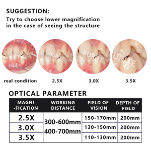 Burite 27-2.5/3.0/3.5X Digitale Vergrootglas Loepen Metalen <span class=keywords><strong>Galileo</strong></span> Lenzen Paren Groot Gezichtsveld Hoge Kwaliteit Optisch Glas - Product Image 3