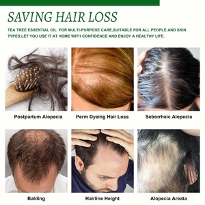 Stärkende Haarwurzel-Tropfen Teebaumöl Batana-Öl Arganöl Rizinusöl Pfefferminzöl Rosmarinöl Haarwachstum für Männer Frauen Follikel - Product Image 2