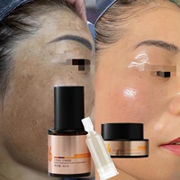 Best-seller - Ensemble de soin pour éliminer les taches noires et les taches brunes - Correcteur de teint - Traitement du mélasma - Gommage chimique pour le visage - Kits professionnels 3 en 1