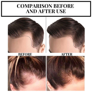 Ormula-sistema de ventilación para el hogar, sistema de ventilación para el aire - Product Image 6