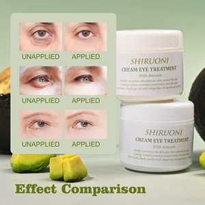 Crema de Ojos de aguacate orgánica vegana personalizada brillo ajuste suaviza las líneas finas hidratante antiarrugas reafirmante instantáneo - Product Image 4
