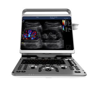 <span class=keywords><strong>Chison</strong></span> Ebit50 Instruments à ultrasons médicaux portables 4d, <span class=keywords><strong>Machine</strong></span> à ultrasons - Product Image 2
