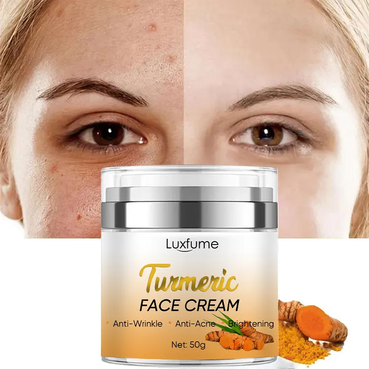 Whitening Beauty Face Cream Anti Acne Remove Dark Spots Turmeric Vitamin C Cream