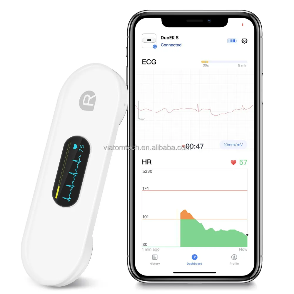 Viatom Mini Ecg portabel Single Lead Ecg elektrokardiogram Bluetooth Monitor OLED pasien Ecg Ekg Ekg Monitor