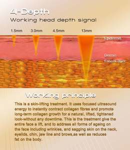 Heetverkopende <span class=keywords><strong>high</strong></span>-intensity focuscartridges werkkop voor facelifting en huidversteviging 1,5 mm 3,0 mm 4,5 mm 13 mm - Product Image 5