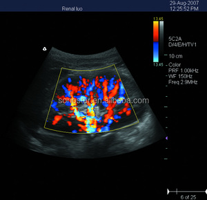 C10m 40 kênh siêu âm DOPPLER màu máy tính xách tay máy siêu âm - Product Image 2