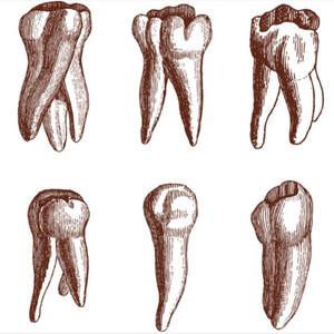Canini dentali incisivi molari denti polpa cavità modello 3D - Product Image 4