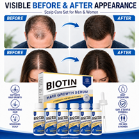 Sérum capillaire à la biotine et au romarin, marque privée OEM, lot de 6 flacons avec complexe de caféine et de peptides pour cheveux fragiles, hommes et femmes, 420 ml, vente en gros