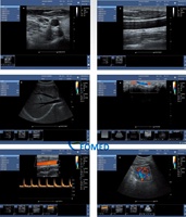 Machine de scanner d'ultrason d'écho de PC 2D humain vétérinaire de conception conviviale de grand écran avec le grand angle de vue, image claire CU09