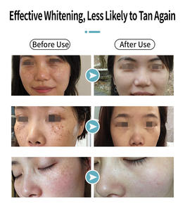 Glutathion-Mikro infusion ampulle mit Vitamin C-Trane xam säure 5ml Reduziertes Glutathion-Fläschchen serum zur Aufhellung der Gesichtshaut - Product Image 4