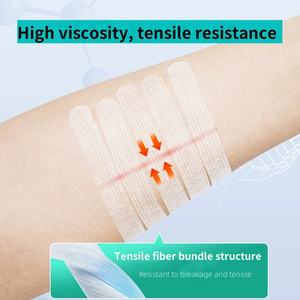 แถบกาวปิดแผลสำหรับผ่าตัดแผ่นรัดแผลทางการแพทย์ - Product Image 6