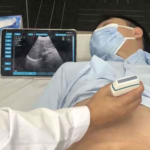 Genggam kualitas tinggi 128 elemen Convex & phyed Probe + Linear Probe 3 in 1 warna nirkabel <span class=keywords><strong>Doppler</strong></span> pemindai Ultrasound - Product Image 5
