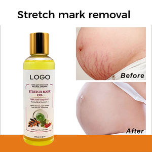 <span class=keywords><strong>Huile</strong></span> essentielle de massage corporel crème vergetures puissante et efficace <span class=keywords><strong>pour</strong></span> l'élasticité de la récupération de la peau - Product Image 4