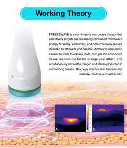 Máquina Reafirmante Corporal Coolwave Sin Impuestos, Tratamiento No Invasivo para la Celulitis, Tensado de Piel Dirigido, Eliminador de Celulitis - Product Image 3