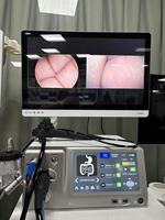 Sistem Kamera Endoskopi Portabel XINMA Sumber Cahaya Dingin Monitor LED 24-inci Daya Listrik Plug-In untuk Medis Veteriner THT