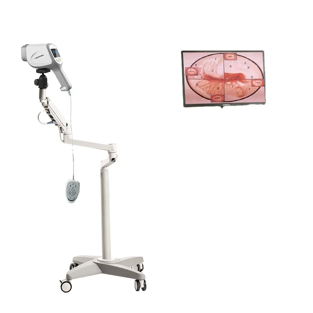 جهاز تنظير المهبل الطبي, جهاز تنظير المهبل الطبي بسعر مناسب جهاز فعال موديل KN2200A