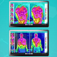 Caméra d'imagerie thermique infrarouge pour équipement de médecine traditionnelle chinoise à imagerie thermique numérique