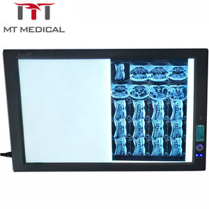 Visualizzatore di pellicole mediche MT MEDICAL di alta qualità, ultra sottile, a doppio <span class=keywords><strong>LED</strong></span>, per raggi <span class=keywords><strong>X</strong></span>, con controllo digitale completo. - Product Image 3