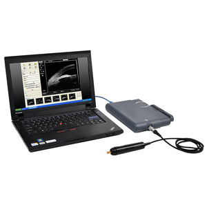 Ecógrafo Oftálmico, Ultrasonido <span class=keywords><strong>Ocular</strong></span>, Biomicroscopio de Ultrasonido Oftálmico para Oftalmología - Product Image 3