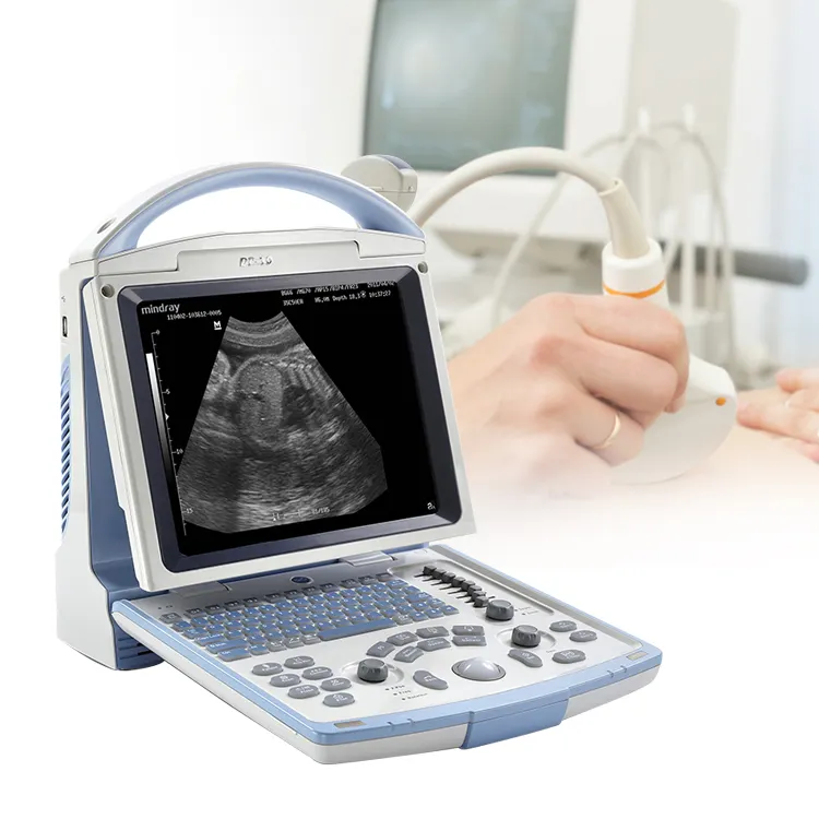Medical Mindray DP-10 Portable full digital ultrasound machine portable with color screen