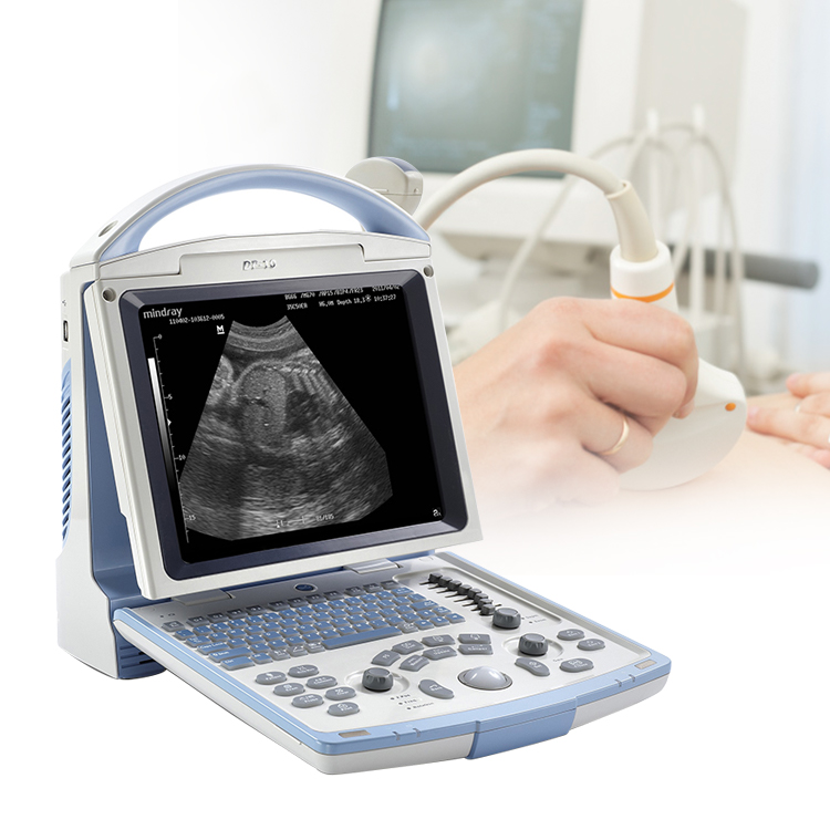 Medical Mindray DP-10 Portable Full Digital Ultrasound Machine Portable With Color Screen