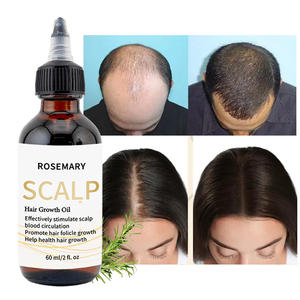 Huile de croissance des cheveux nutritionnelle sérum liquide de soin du cuir chevelu pour <span class=keywords><strong>Essence</strong></span> pour soin des cheveux huile de soin des cheveux essentielle - Product Image 5