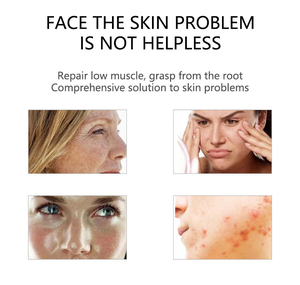 Appareil <span class=keywords><strong>de</strong></span> soins du visage meilleur hydras facial près <span class=keywords><strong>de</strong></span> moi/avantages professionnels du visage hydras/<span class=keywords><strong>prix</strong></span> du visage hydras - Product Image 3