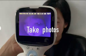 Optometry Equipment Non Mydriatic Portable <b>Digital</b> Retinal Fundus <b>Camera</b> - Product Image 4