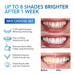 Dental <strong>Bleaching</strong> Kit PAP Gel Fast Result Sensitive Free 16 LED Bulbs Wireless Design Home Use Full <strong>Set</strong> OEM Factory CE Approved - Product Image 6