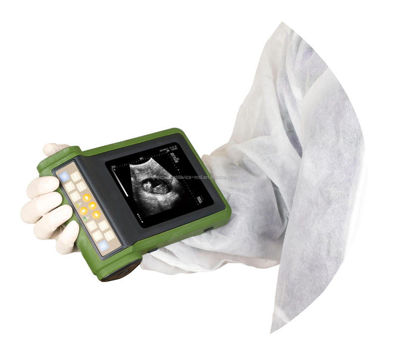 Mindray Veterinary Ultrasound Scanner Color Doppler