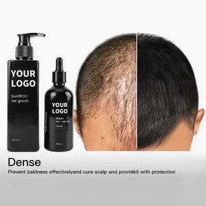 Фирменная торговая марка, 100% натуральный органический набор для ухода за волосами, против выпадения волос, имбирный шампунь и масло для волос