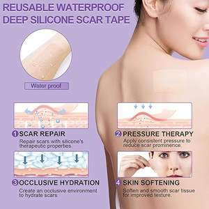 पुनः प्रयोज्य पारदर्शी सिलिकॉन निशान शीट कट चिपकने वाला स्टीकर रबर मास्किंग निशान की मरम्मत टेप प्रभावी घाव ड्रेसिंग के लिए - Product Image 5