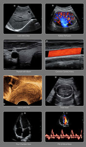 Trolley Kleur Doppler Echografie Machine Ecografo Mindray DC-26 - Product Image 5