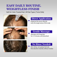 Sérum de croissance capillaire roll-on Redensyl Anagain pour des cheveux plus épais, formule légère à base d'eau, bloqueur de DHT, soutien du microbiome du cuir chevelu