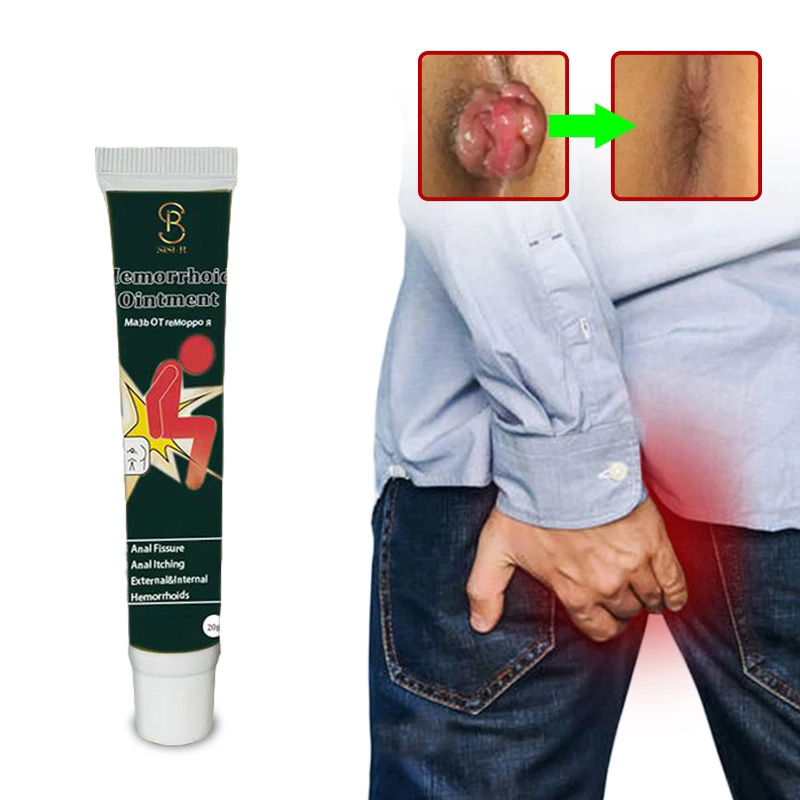 OEM Custom Logo Hemorrhoids Ointment Internal Piles External Anal Fissure Anus Bleeding Anal Pain Cream