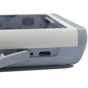 Fabrication de plusieurs <span class=keywords><strong>paramètres</strong></span> vétérinaire portable moniteur de signes <span class=keywords><strong>vitaux</strong></span> PC100SV - Product Image 5