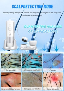 AU-DS3 AI Intelligent Hair Follicle Scalp Analyzer 16MP HD Camera Skin Scalp Detector Machine for Salon Use - Product Image 4