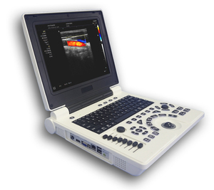 Ecógrafo <span class=keywords><strong>Doppler</strong></span> Color <span class=keywords><strong>3D</strong></span> Veterinario Portátil para Perros y Gatos, Máquina de Ultrasonido <span class=keywords><strong>Doppler</strong></span> Color para Diagnóstico de Gestación - Product Image 5
