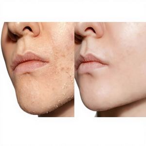 IVOSKIN ลักชัวรี่ ไรซ์ มิลค์กี้ โฟม บับเบิ้ล โทนเนอร์ ลิควิด ไฮเดรติ้ง ไลท์เทนนิ่ง กระชับรูขุมขน ปรับสมดุลทุกสภาพผิว ไนอะซินาไมด์ - Product Image 1