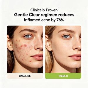 Crème <span class=keywords><strong>hydratante</strong></span> anti-acné OEM à l'acide salicylique pour resserrer les pores, matifier, hydrater les peaux sensibles et améliorer la texture de la peau - Product Image 4