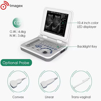 Échographe portable pour ordinateur portable avec transducteur convexe transvaginal et linéaire