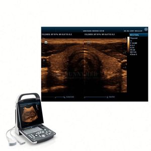 Instrumento de ultrasonido médico DP20 2D Color Doppler Ultrasonido Uso humano Digital <span class=keywords><strong>Mindray</strong></span> BW Ultrasonido - Product Image 5
